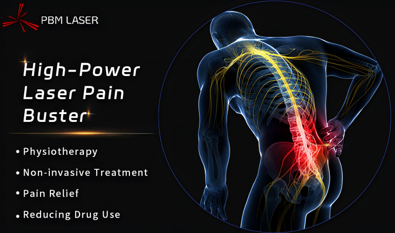 PBM Medical Laser 丨 Desbloqueando el código de rehabilitación, el láser de alta potencia recibe una recomendación de grado A en las pautas de diagnóstico y tratamiento del dolor lumbar crónico de China (edición 2024)